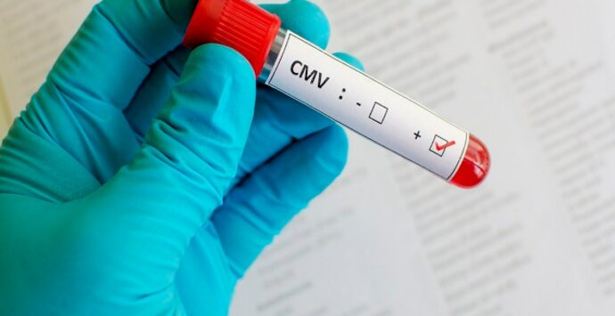Caso di coronavirus a Roggiano Gravina: tampone positivo. Le ultime novità
