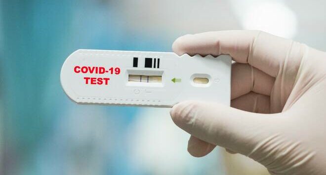 Presto una novità in arrivo: test covid “fai da te” in farmacia
