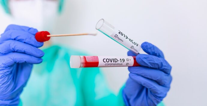 Covid, tamponi antigenici rapidi al Centro Sanitario Unical