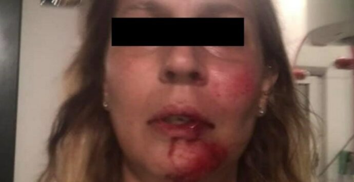 Tortora, una donna è stata aggredita brutalmente da 4 persone