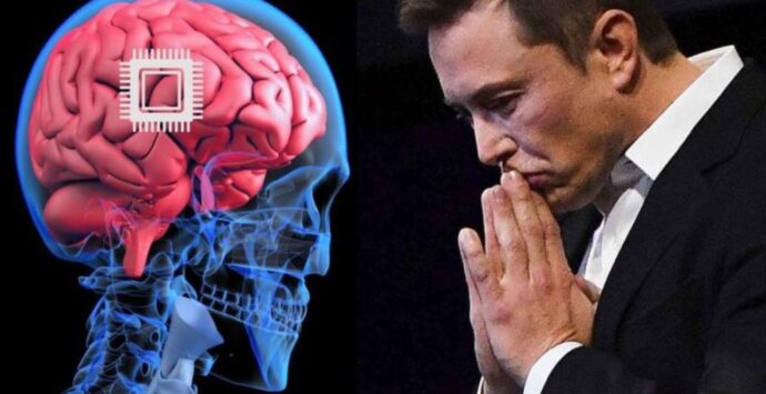 L’annuncio di Elon Musk: «Il paziente con chip nel cervello muove il mouse col pensiero»